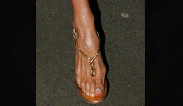 Ünlülerin bilmediğiniz defoları