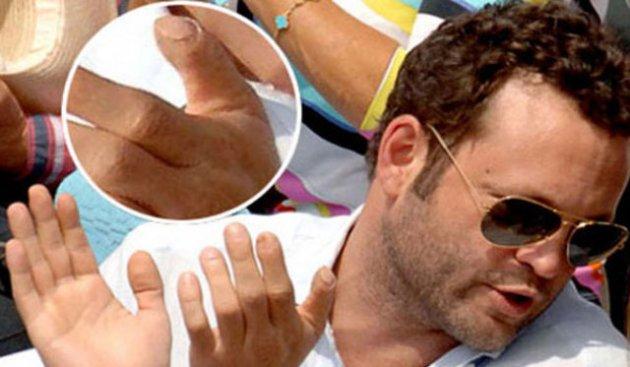 Ünlülerin bilmediğiniz defoları