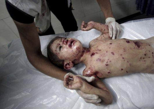 İsrail Gazze'de katliam yapıyor