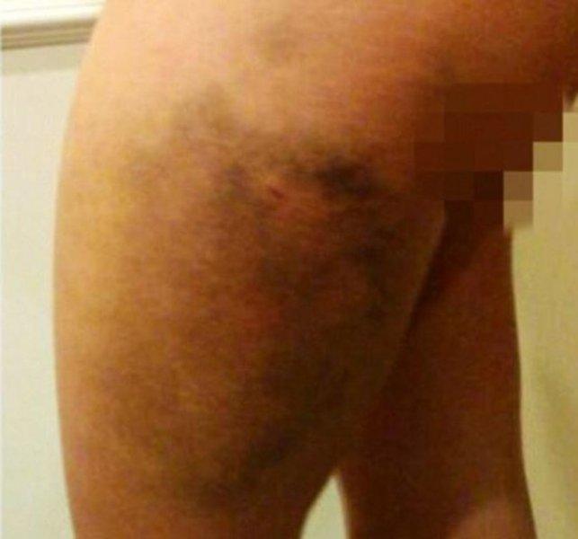 Christy Mack'i eski sevgilisi  hastanelik etti