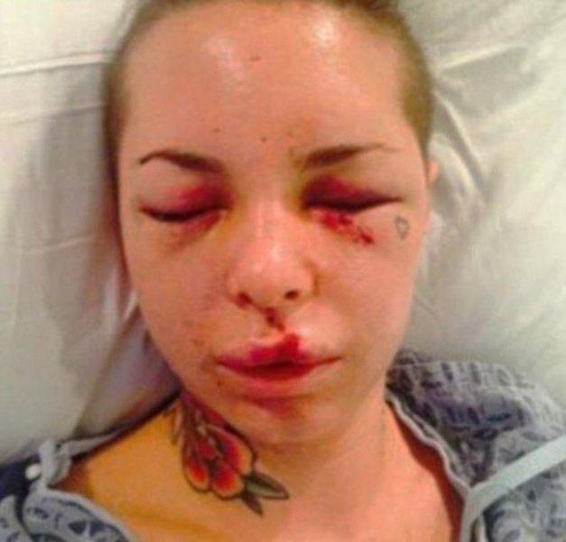 Christy Mack'i eski sevgilisi  hastanelik etti