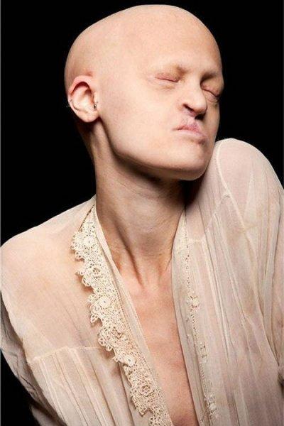 Dünyanın en sıradışı mankeni Melanie Gaydos 