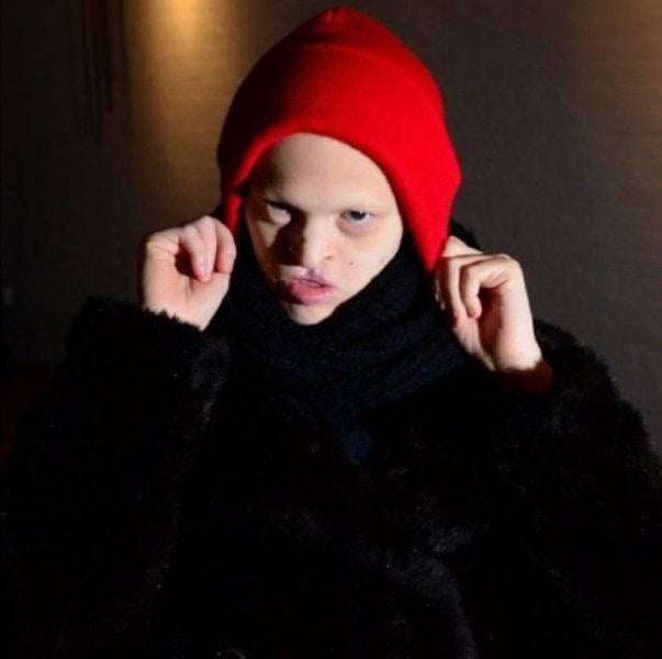 Dünyanın en sıradışı mankeni Melanie Gaydos 