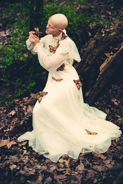 Dünyanın en sıradışı mankeni Melanie Gaydos 