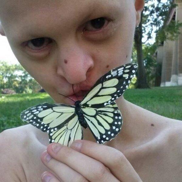 Dünyanın en sıradışı mankeni Melanie Gaydos 