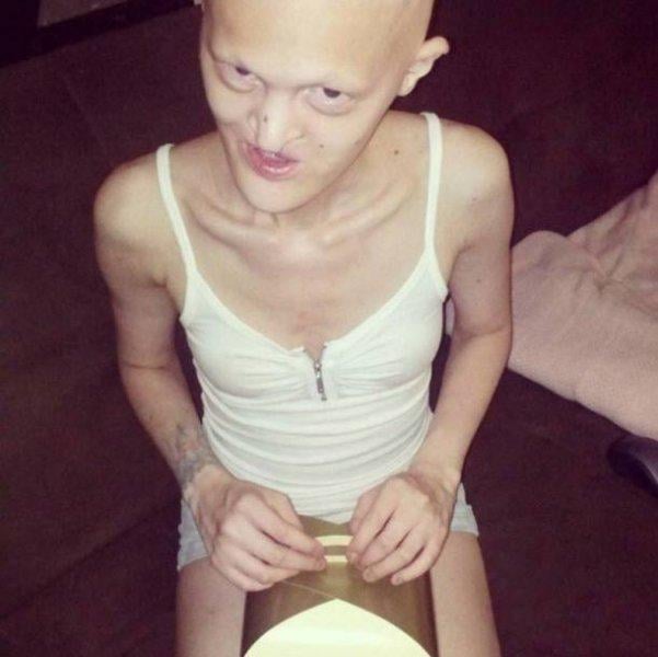 Dünyanın en sıradışı mankeni Melanie Gaydos 