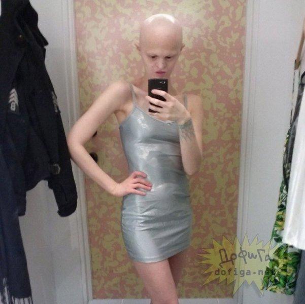 Dünyanın en sıradışı mankeni Melanie Gaydos 