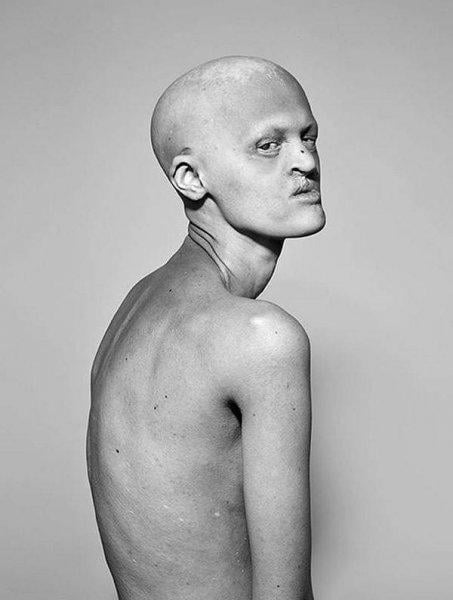 Dünyanın en sıradışı mankeni Melanie Gaydos 