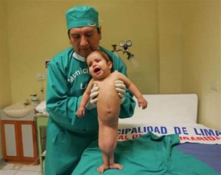 Küçük Denizkızı Milagros Cerron 10 yaşında 