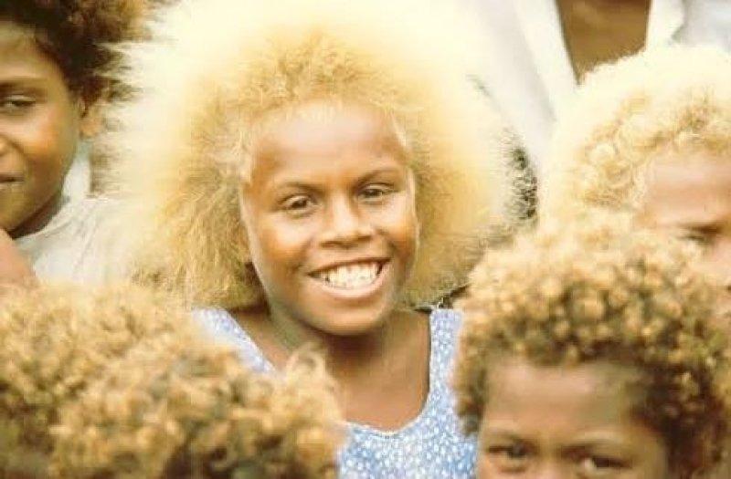 Doğal sarışınlar hakkında bilmeyen ilginç gerçekler