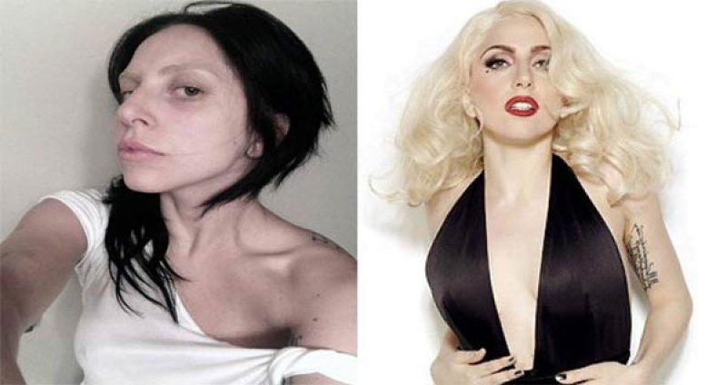 Ünlülerin bakımsız halleri korkuttu 