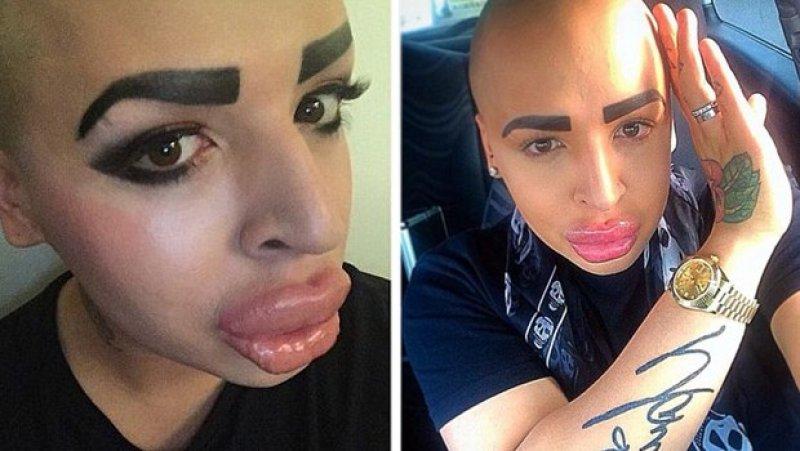 Kardashian'a benzemek için 350 bin lira harcadı