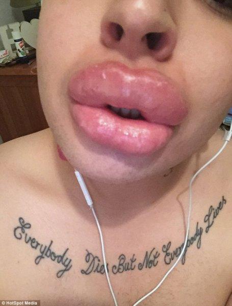 Kardashian'a benzemek için 350 bin lira harcadı