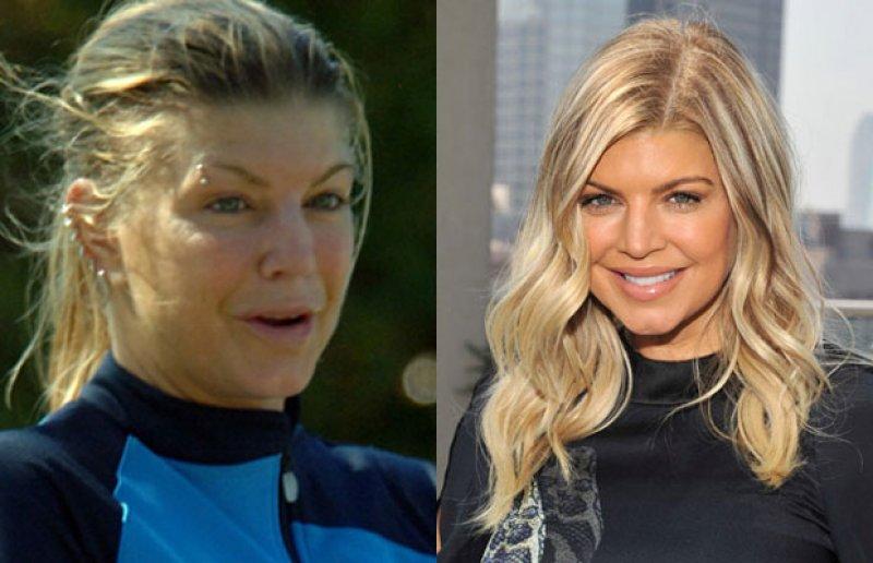 Ünlülerin bakımsız halleri korkuttu 