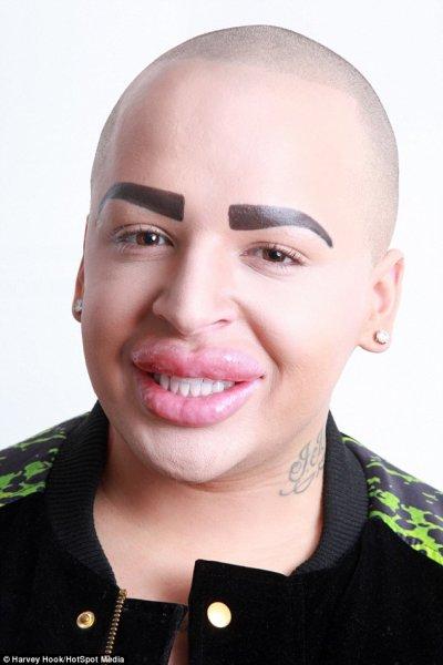 Kardashian'a benzemek için 350 bin lira harcadı