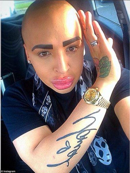 Kardashian'a benzemek için 350 bin lira harcadı