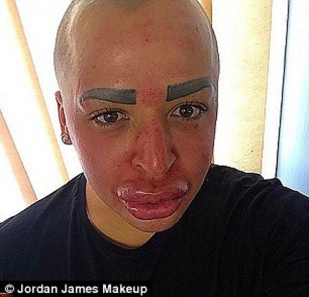 Kardashian'a benzemek için 350 bin lira harcadı