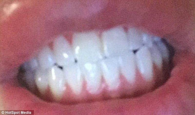 Kardashian'a benzemek için 350 bin lira harcadı