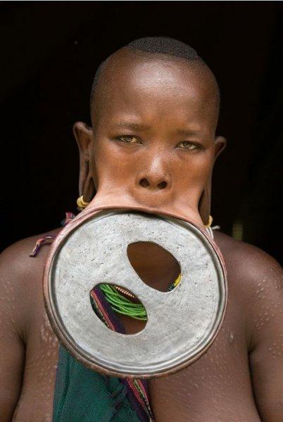 Dünyanın en büyük dudaklı kadını Ataye Eligidagne