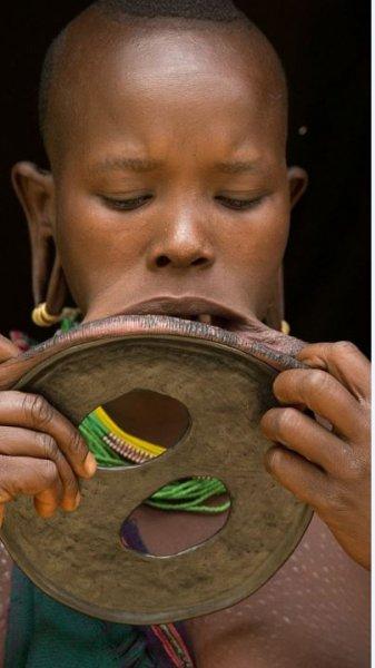 Dünyanın en büyük dudaklı kadını Ataye Eligidagne