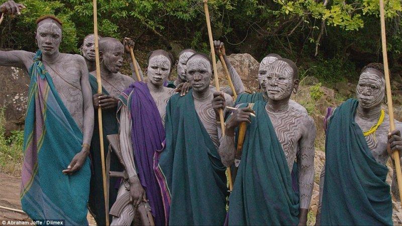 Dünyanın en büyük dudaklı kadını Ataye Eligidagne