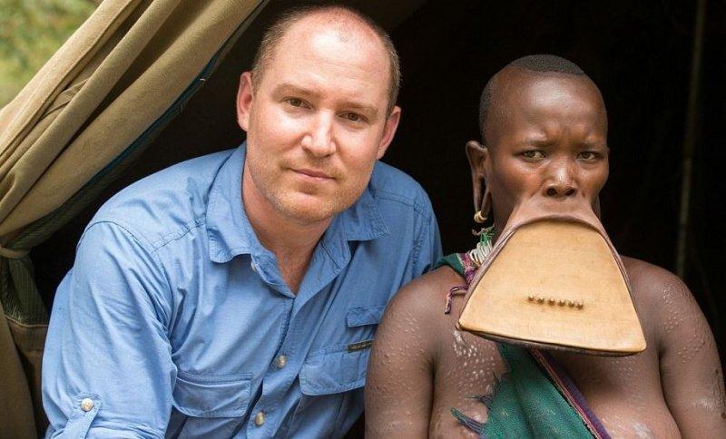 Dünyanın en büyük dudaklı kadını Ataye Eligidagne