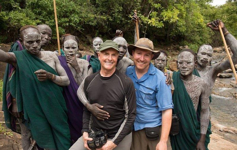 Dünyanın en büyük dudaklı kadını Ataye Eligidagne