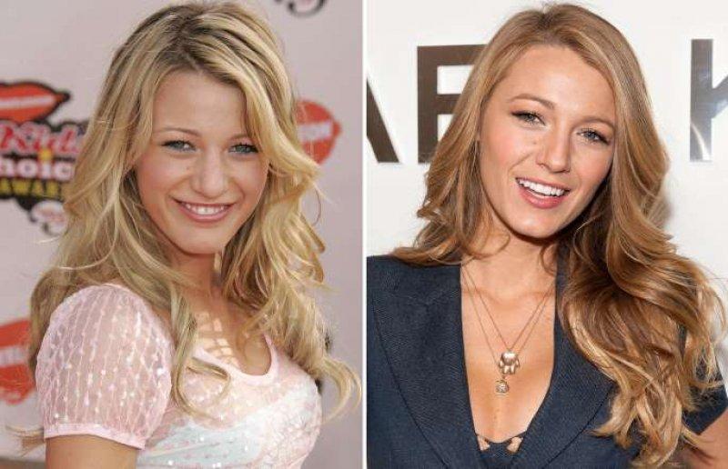 Dünyaca ünlü isimlerin gençlik halleri