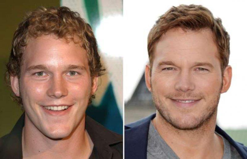 Dünyaca ünlü isimlerin gençlik halleri