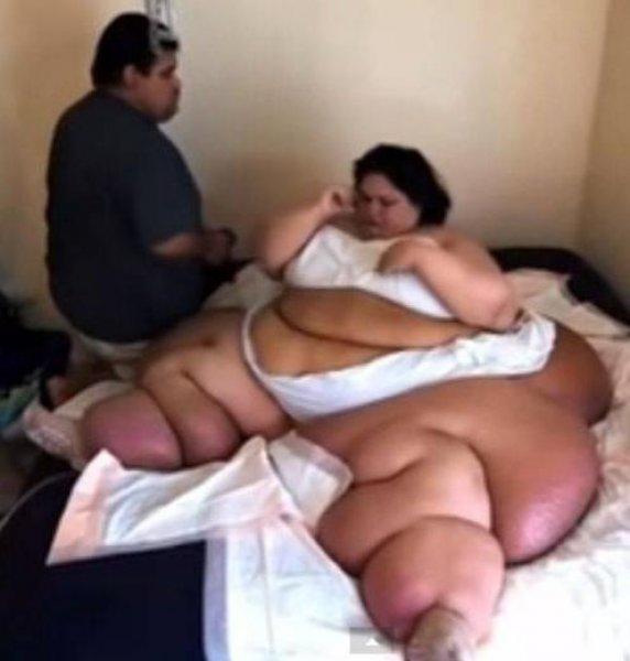 Mayra Rosales geçirdiği 11 ameliyat sonrası 362 kilo verdi 