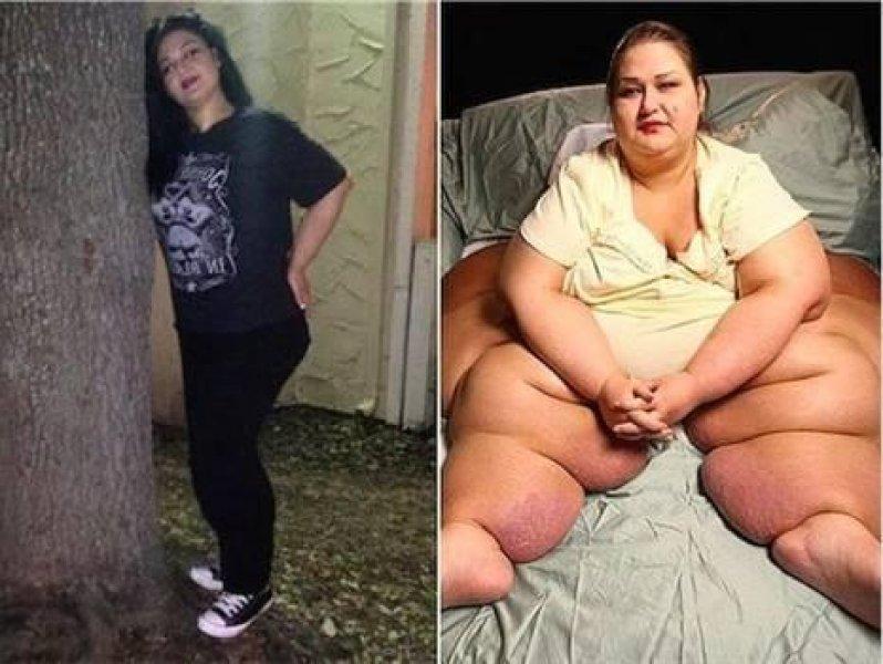 Mayra Rosales geçirdiği 11 ameliyat sonrası 362 kilo verdi 