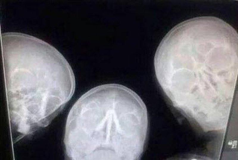 Dünyanın en çılgın selfie fotoğrafları