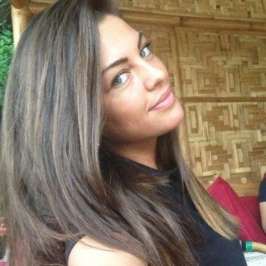 Sinem Umaş'ın inanılmaz değişimi  - Resim 35