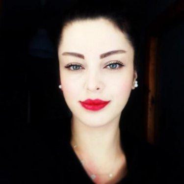 Sinem Umaş'ın inanılmaz değişimi  - Resim 56