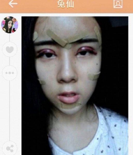 Çinli genç kız Lee Hee Danae 15 yaşında estetik kurbanı oldu 