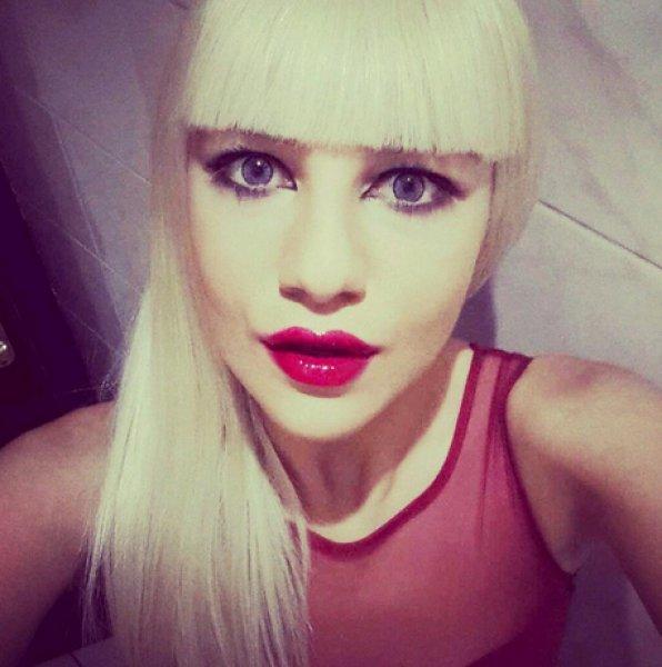 Ayşenur Balcı estetik yaptırdı