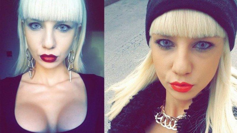 Ayşenur Balcı estetik yaptırdı