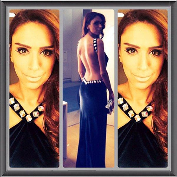 Tuğçe Ergişi estetik yaptırdı