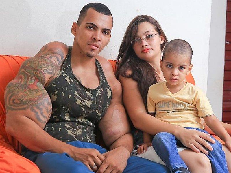 Santos Alves kas uğruna kollarından oluyordu 