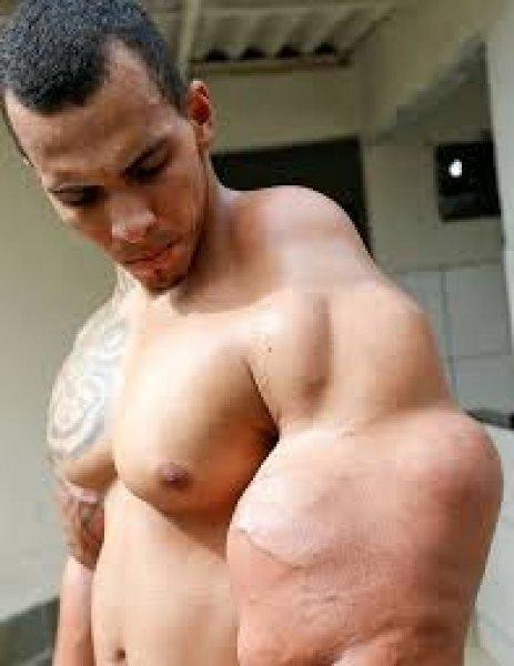 Santos Alves kas uğruna kollarından oluyordu 