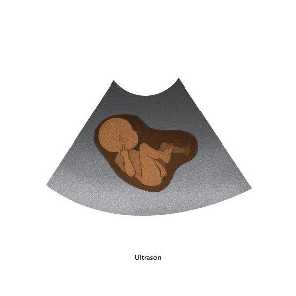 İlk kez anne baba olacaklar dikkat