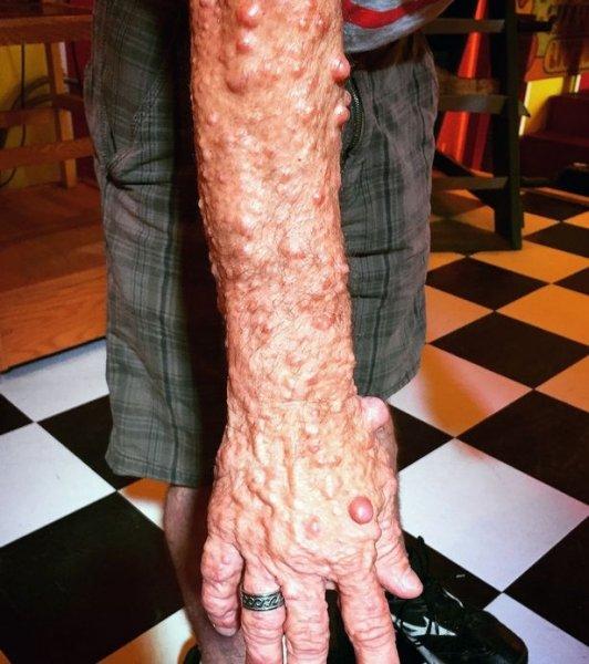 Dünyadaki en ilginç hastalıklar