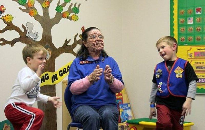 Dünyadaki en ilginç hastalıklar