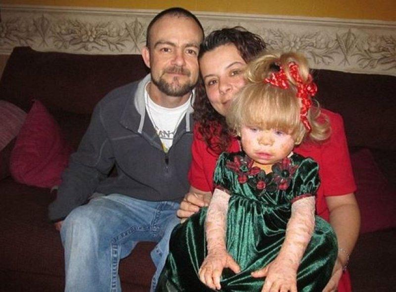 Dünyadaki en ilginç hastalıklar