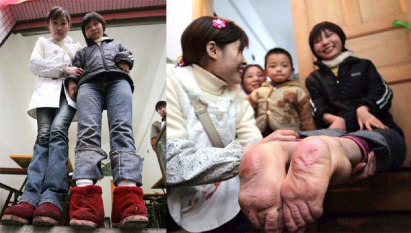 Dünyadaki en ilginç hastalıklar