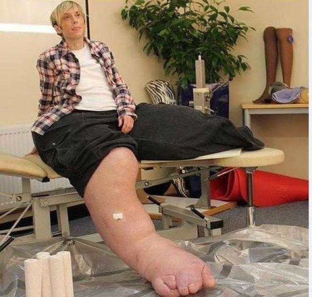 Dünyadaki en ilginç hastalıklar