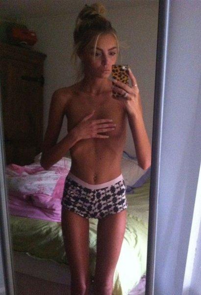 Dünyadaki en ilginç hastalıklar