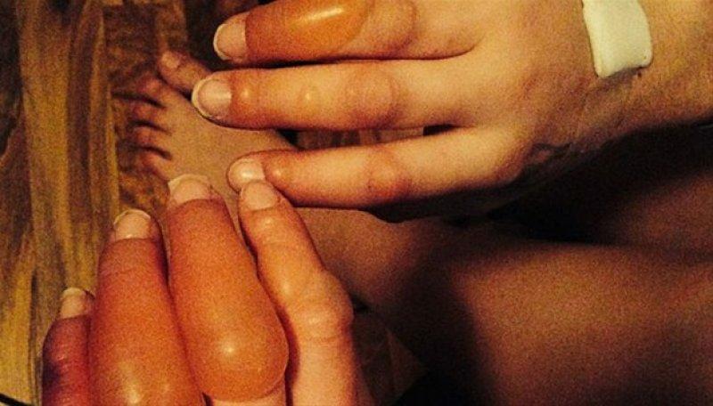 Dünyadaki en ilginç hastalıklar