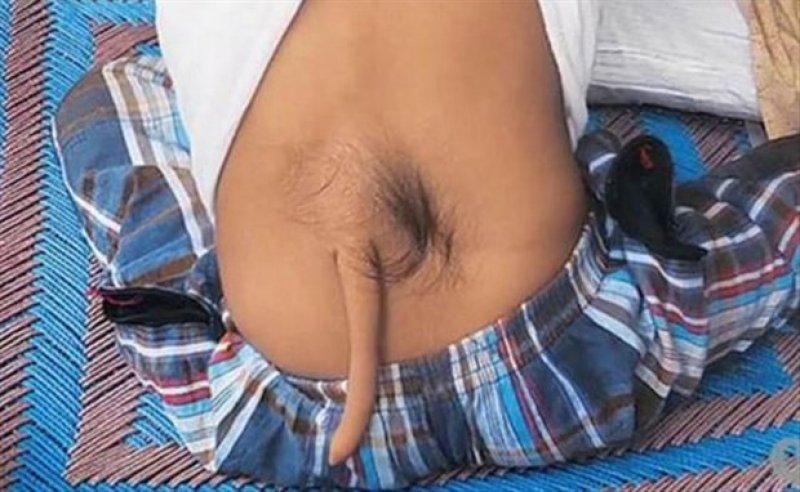 Dünyadaki en ilginç hastalıklar