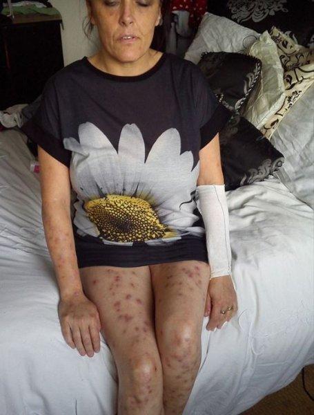 Dünyadaki en ilginç hastalıklar